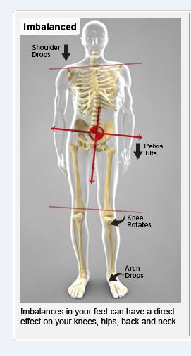 Back Pain Due To Pelvic Imbalance/Misalignment