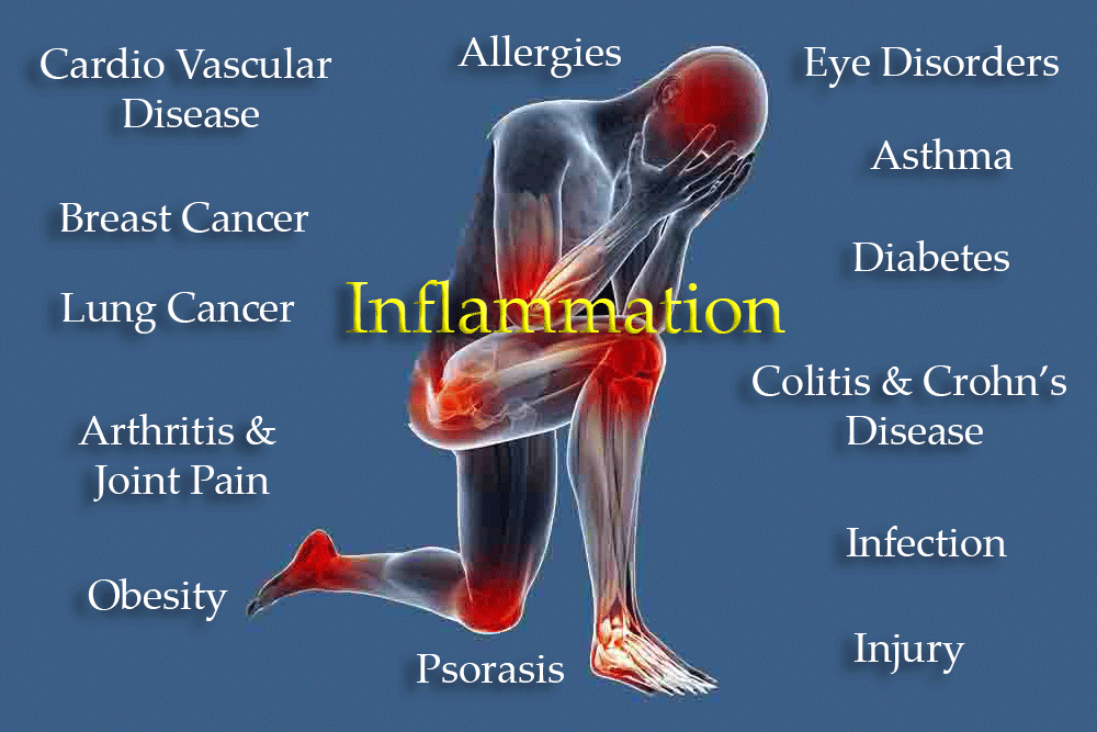 Food Sources That Reduce/Eradicate Allergies & Inflammation