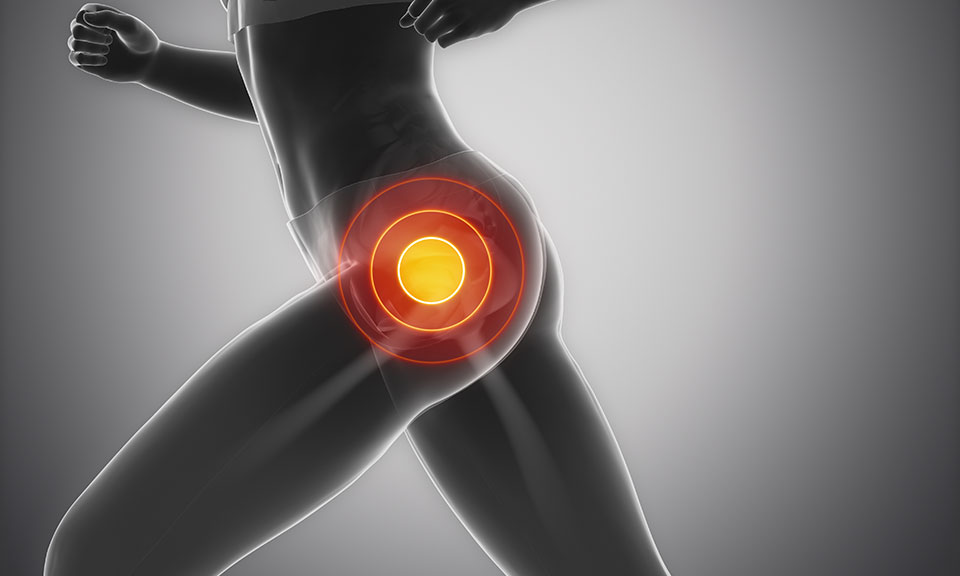 Suffering From Hip Pain? Stop Crossing Your Legs and Standing On One Leg.