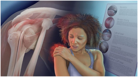 My Clicking Shoulder