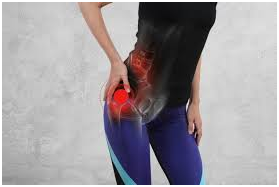 Sciatica And Piriformis Syndrome