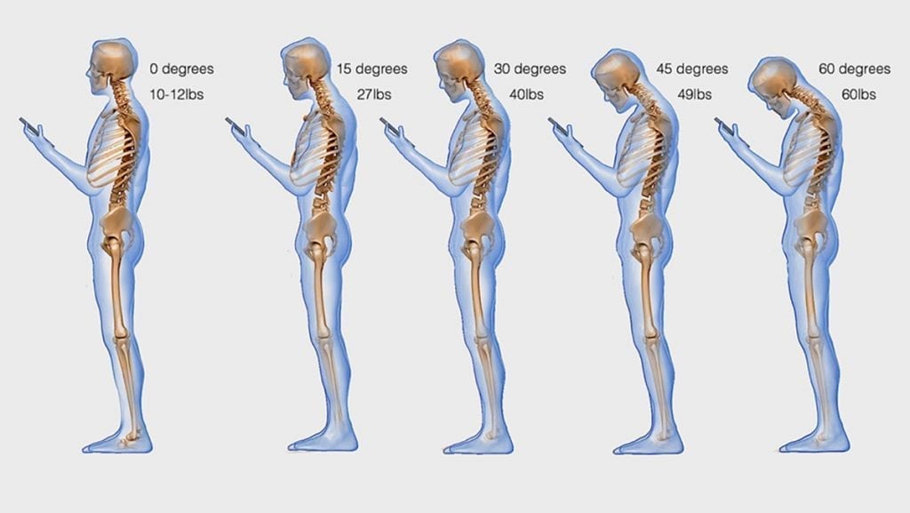 Combating Text Neck: Tips To Reduce Strain And Improve Posture