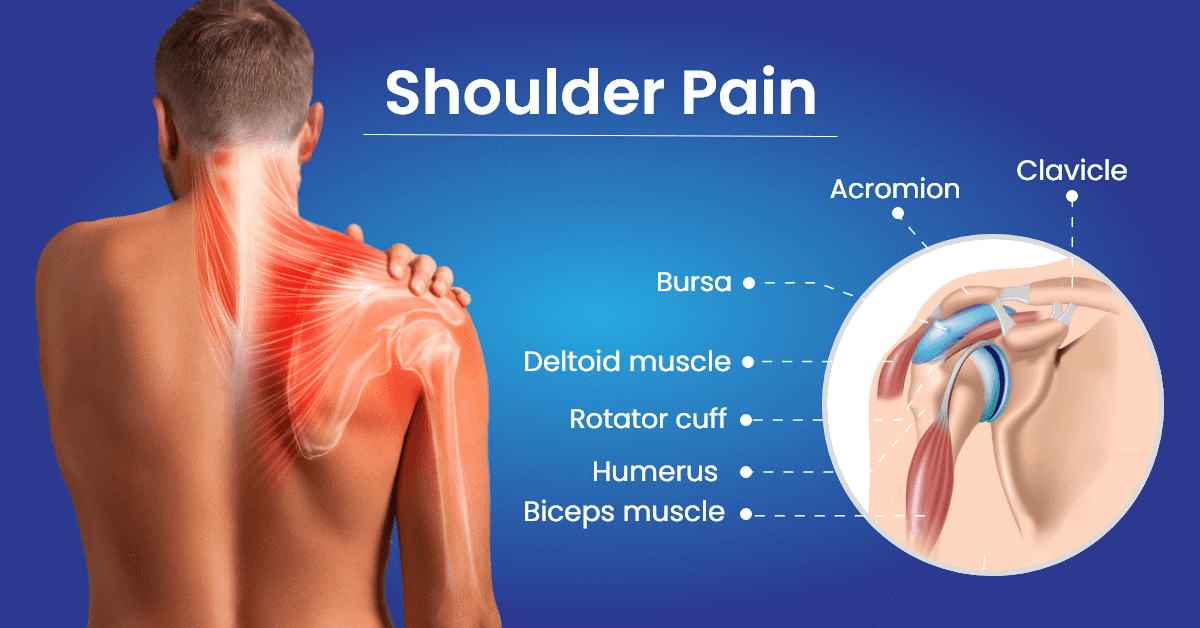 What Is That Pain In My Shoulder?